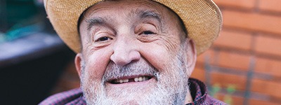 Chaska patient with missing teeth smiling