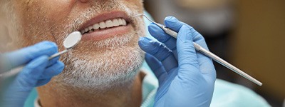 Nose-to-neck view of man with white beard about to have mouth examined