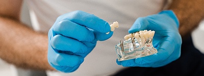 a dentist showing a patient how dental implants work with a model of a mouth