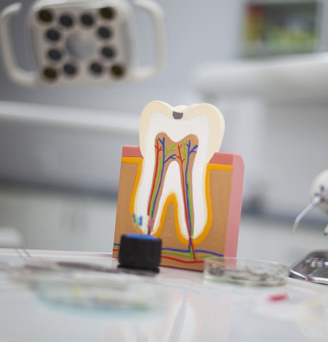 model of a dental implant in Chaska being placed in a patient’s mouth