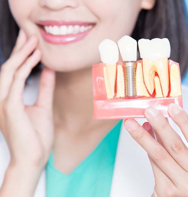 dentist holding a model of a dental implant in the jaw