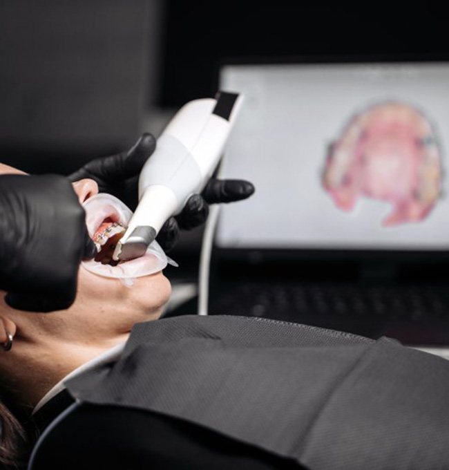 a patient undergoing a checkup involving an iTero scanner