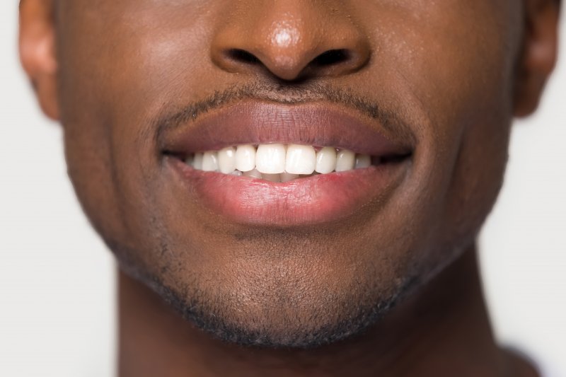 smiling with porcelain veneers