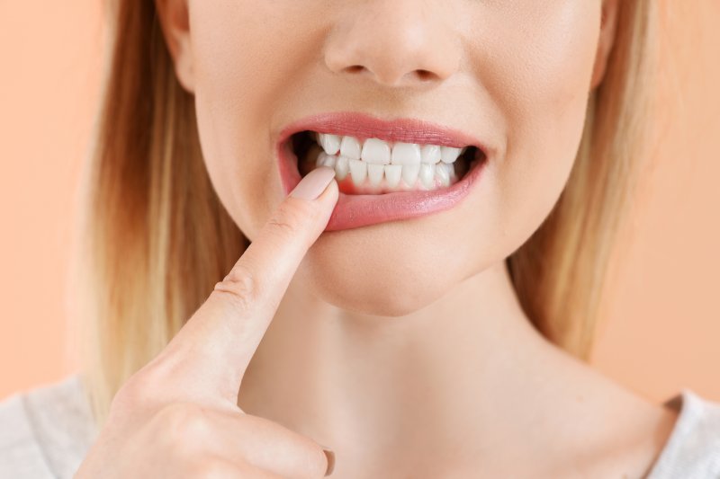young woman pointing to unhealthy gums