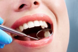 a woman getting her dental filling examined